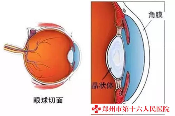 白內障病發原因是什么？能醫治嗎？