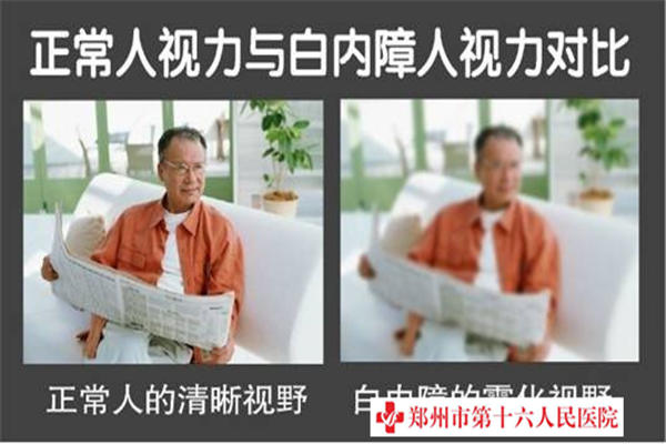 白內障病發原因是什么？能醫治嗎？