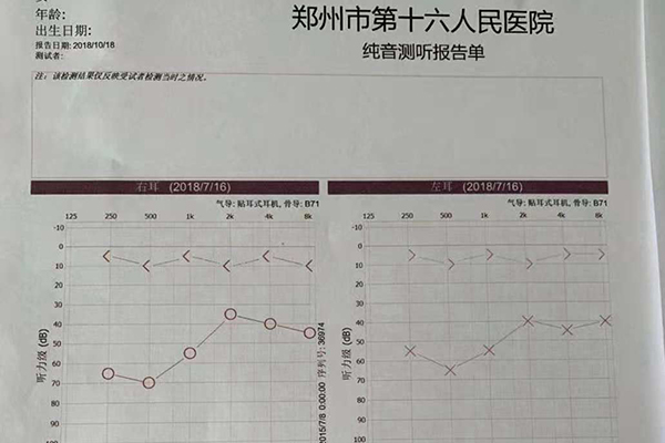 術前檢查聽力受損嚴重