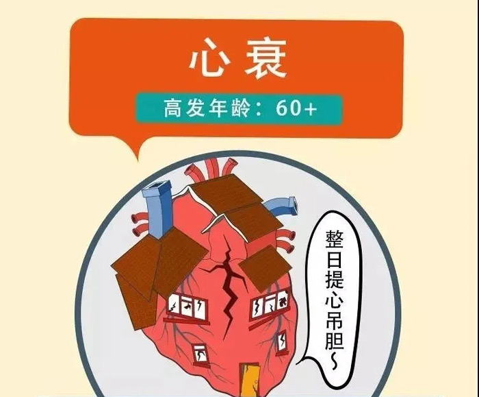 心衰，高發年齡：60+