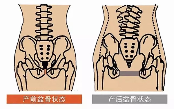 產前產后骨盆狀態