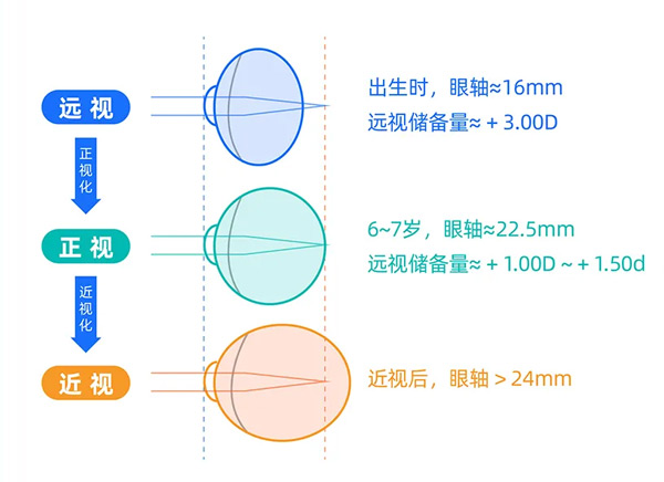 0-6歲兒童眼保健有多重要？