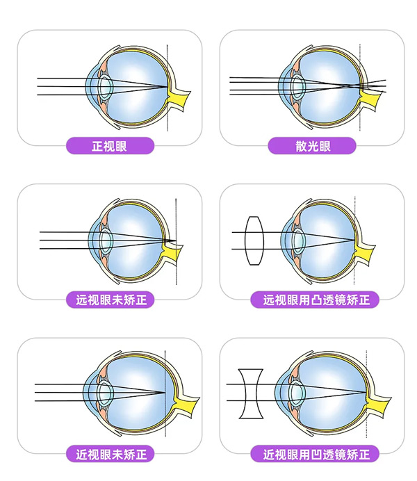 0-6歲兒童眼保健有多重要？