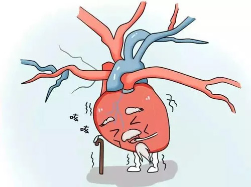 5種信號提示心肌梗死發作 10個時段需要格外警惕