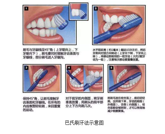 蛀牙真的是牙被蟲蛀了嗎？