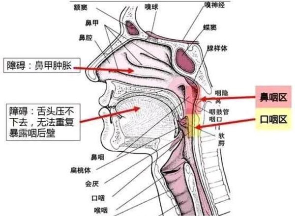 疾控專家告訴你核酸檢測為什么要采口鼻不能采耳？