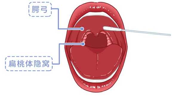 疾控專家告訴你核酸檢測為什么要采口鼻不能采耳？
