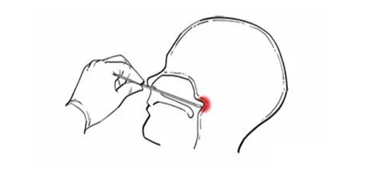 疾控專家告訴你核酸檢測為什么要采口鼻不能采耳？