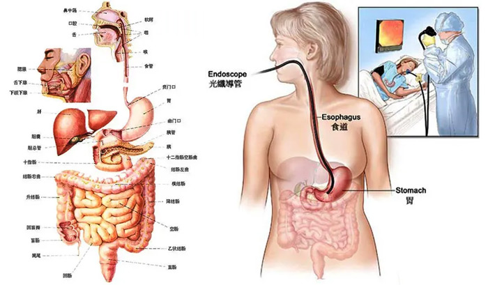 無痛胃鏡有點和檢查前后注意事項