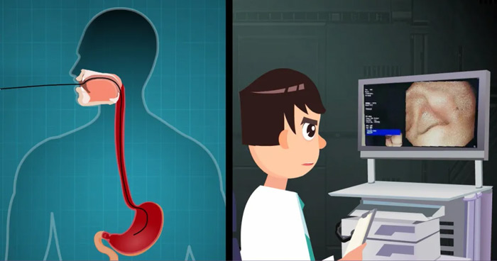 無痛胃鏡有點和檢查前后注意事項