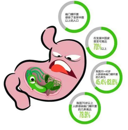 胃痛、反酸、口臭？你可能感染了幽門螺桿菌