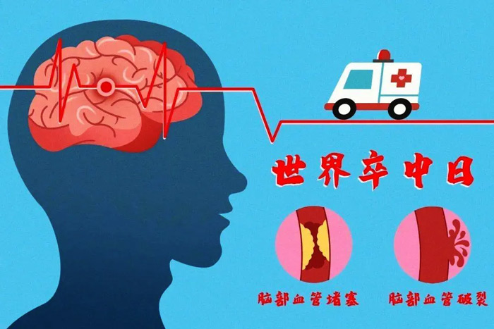 10月29日世界卒中日|分秒“B”爭，救治大腦