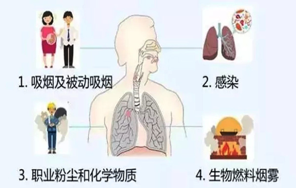 什么是慢阻肺？慢阻肺的早期識別和預防