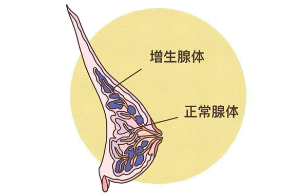 體檢報告你會看嗎？這些指標異常未必就是病