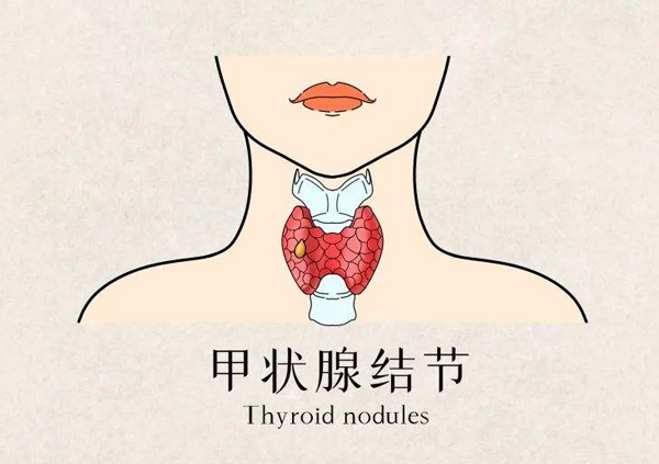 體檢報告你會看嗎？這些指標異常未必就是病