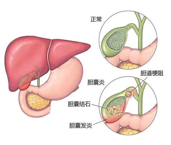 體檢報告你會看嗎？這些指標異常未必就是病