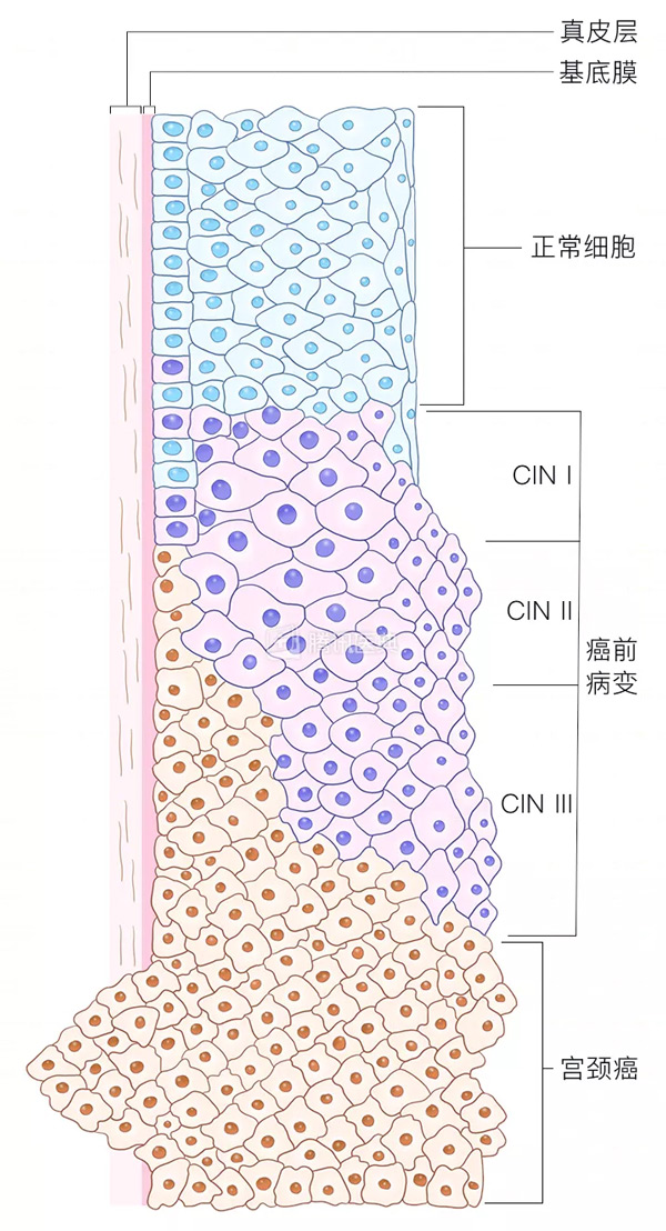 “活檢”是什么？怎么做？