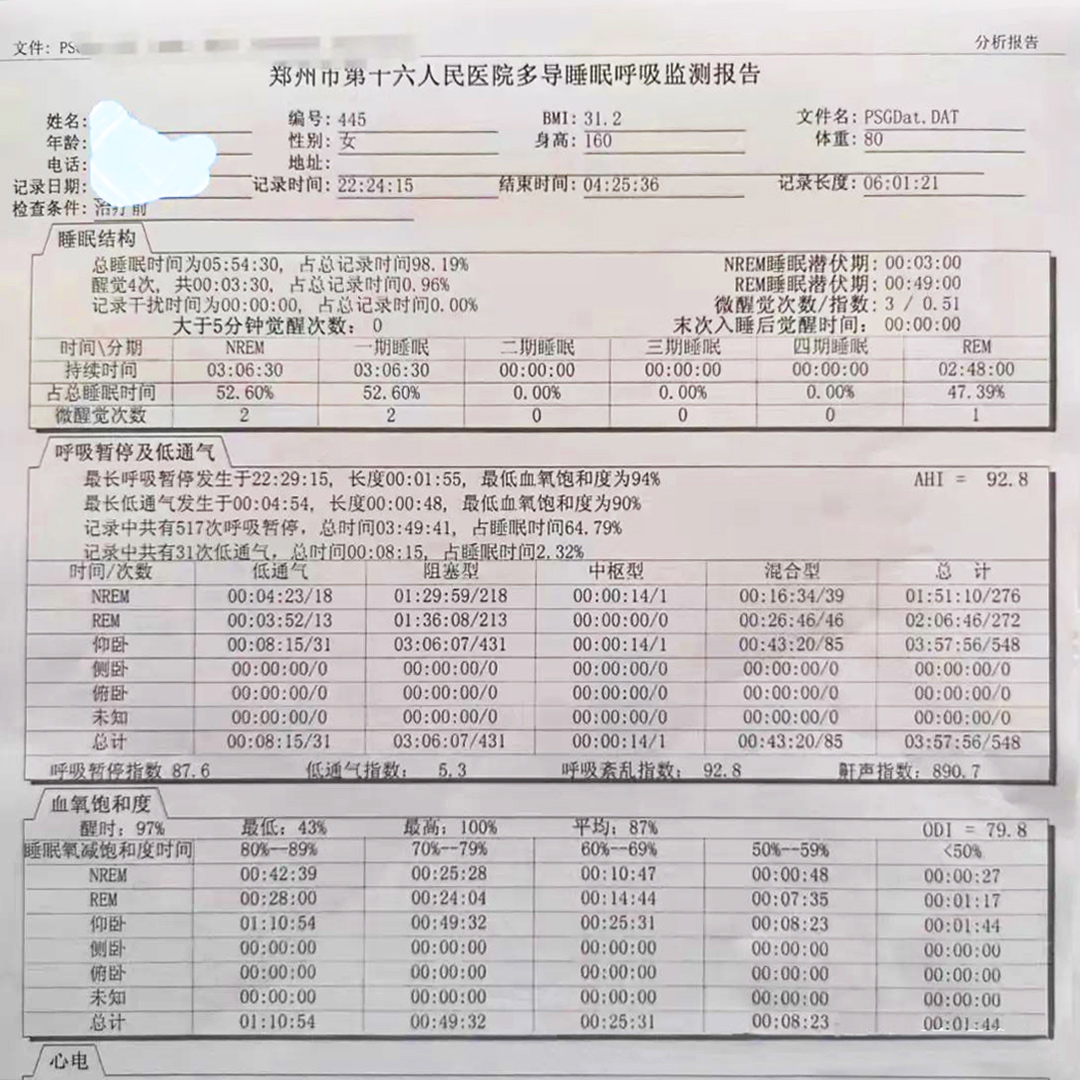 打呼嚕通過什么檢查可以明確類型？