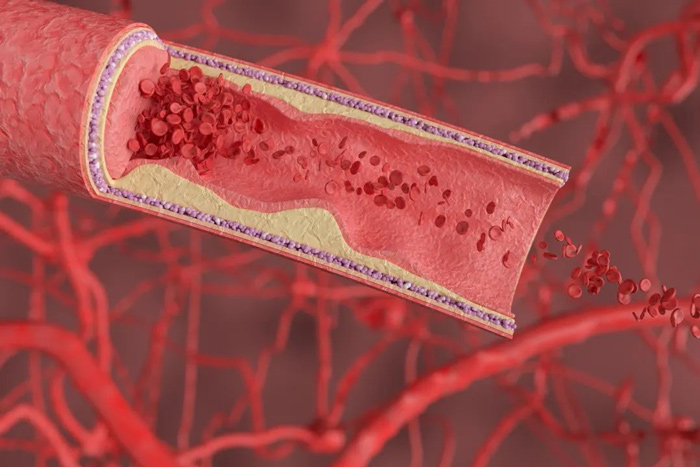 聽說過血管也有“年齡”嗎？如何檢測？