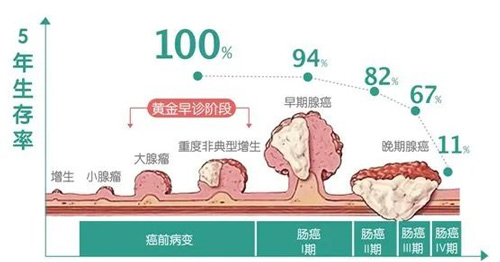 息肉變化過程