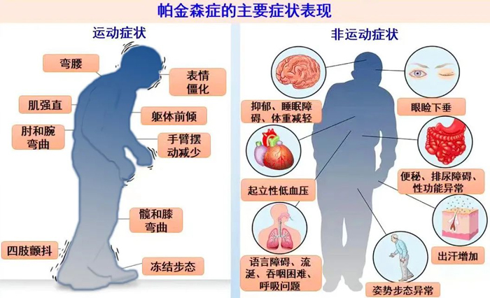 別害“帕”，神經外科團隊一招幫七旬老人逆轉“顫抖命運”