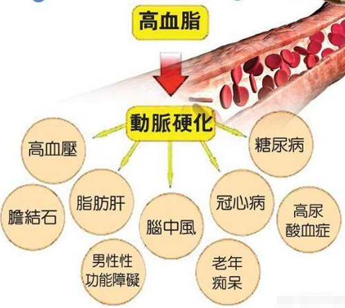 高血脂的常見問題解答