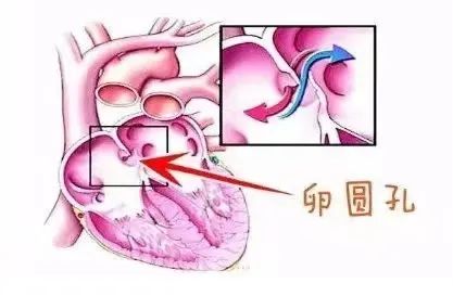 警惕！多年查不出原因的頭痛癥，建議多做這一項檢查……