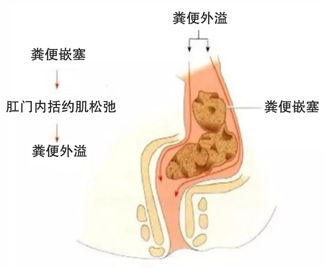 關于“菊花”的難言之隱....