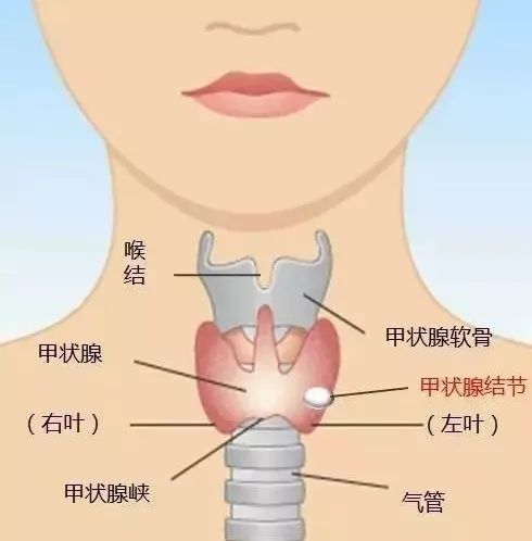 甲狀腺癌沖上“熱搜”！是良是惡？一針見分曉！