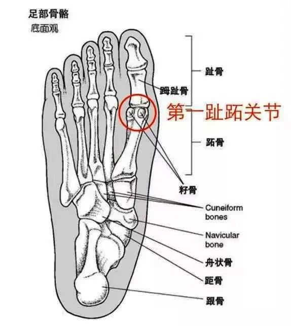 籽骨炎