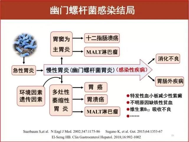 幽門螺旋桿菌感染癥狀