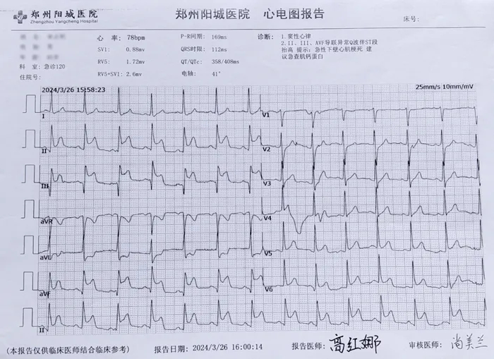 “先診療、后付費”——為急性心肌梗死搶救加速！