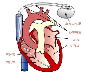 當心臟停擺，誰來拯救？是命運的安排，還是奇跡的降臨？