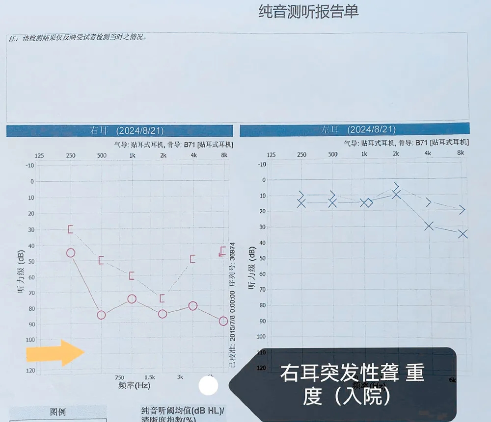 突然聽不見？原來是這個聽力殺手在作祟！